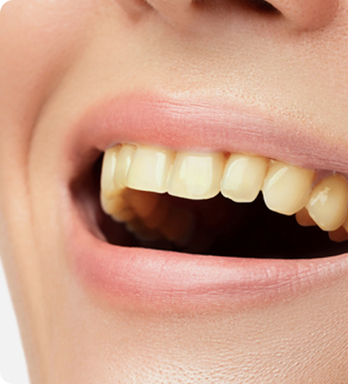 Group 1171276976 (1) Group 1171276976 (1)